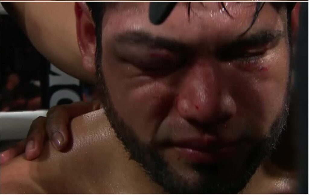 Así terminó el Zurdo Ramírez después de la golpiza que le propinó el Mexican Monster