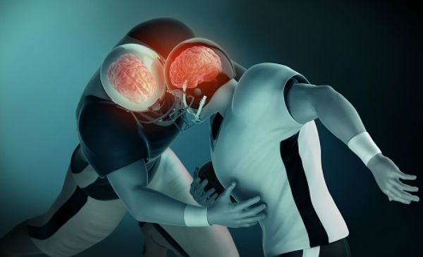 La causa de la CTE son los golpes intensos y frecuentes que recibe el cerebro